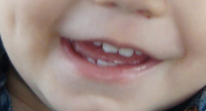 pediatric orthodontist