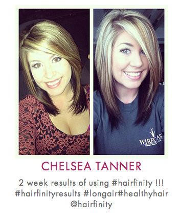 hairfinity before and after
